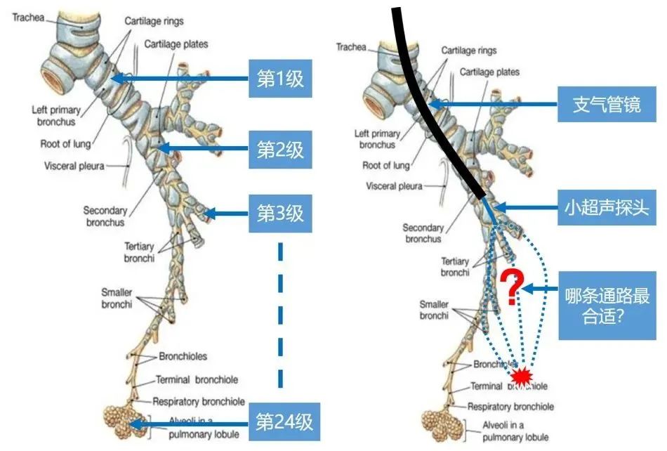 支气管的分级 图图片