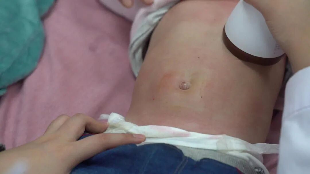 立冬！实用的小儿节气推拿来咯！