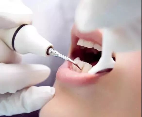 开心过大节丨注意防范“春节口腔病”