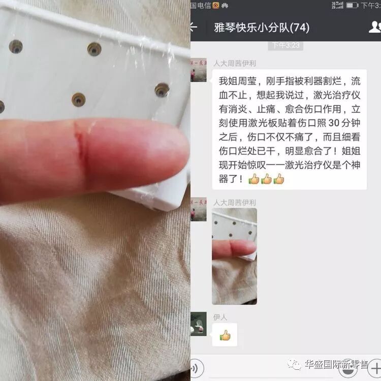激光治疗仪能治什么病激光治疗仪案例整理【外伤，疼痛，皮肤疾病】_https://www.jmylbn.com_新闻资讯_第9张