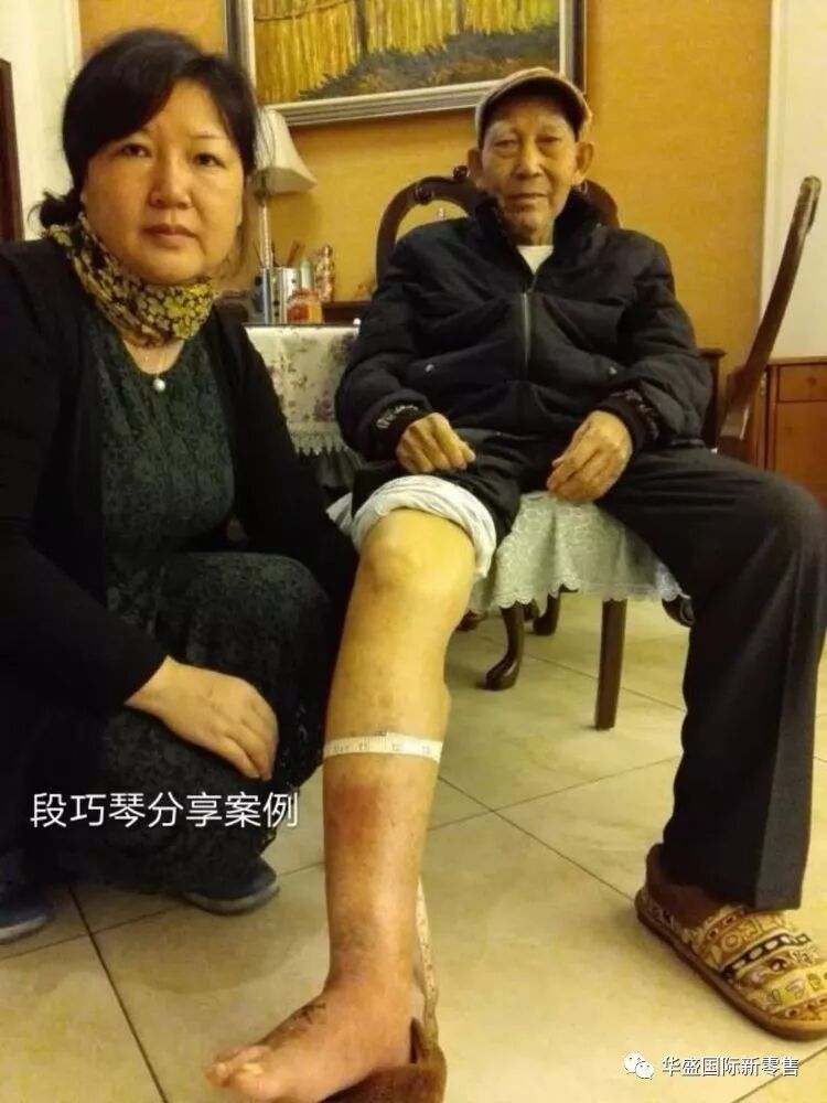 激光治疗仪能治什么病激光治疗仪案例整理【外伤，疼痛，皮肤疾病】_https://www.jmylbn.com_新闻资讯_第8张