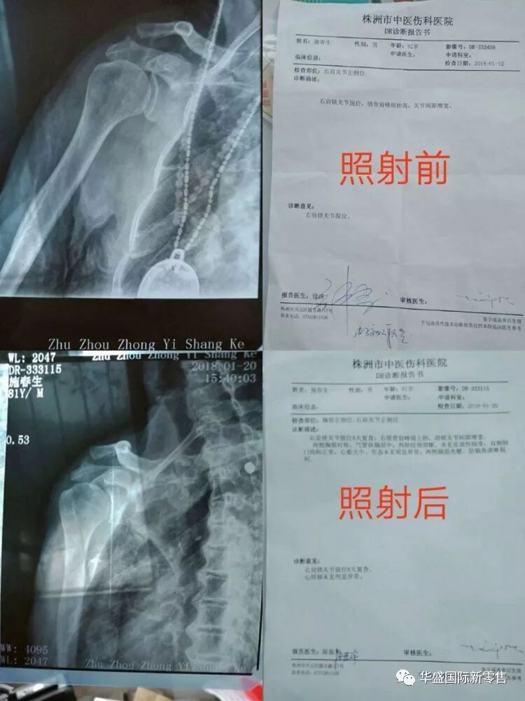激光治疗仪能治什么病激光治疗仪案例整理【外伤，疼痛，皮肤疾病】_https://www.jmylbn.com_新闻资讯_第43张