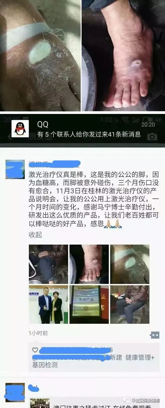 激光治疗仪能治什么病激光治疗仪案例整理【外伤，疼痛，皮肤疾病】_https://www.jmylbn.com_新闻资讯_第24张