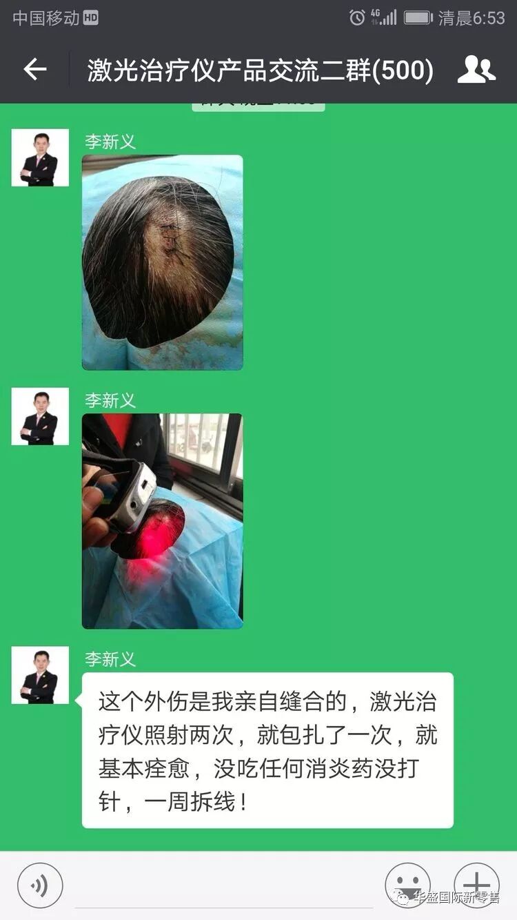 激光治疗仪能治什么病激光治疗仪案例整理【外伤，疼痛，皮肤疾病】_https://www.jmylbn.com_新闻资讯_第30张
