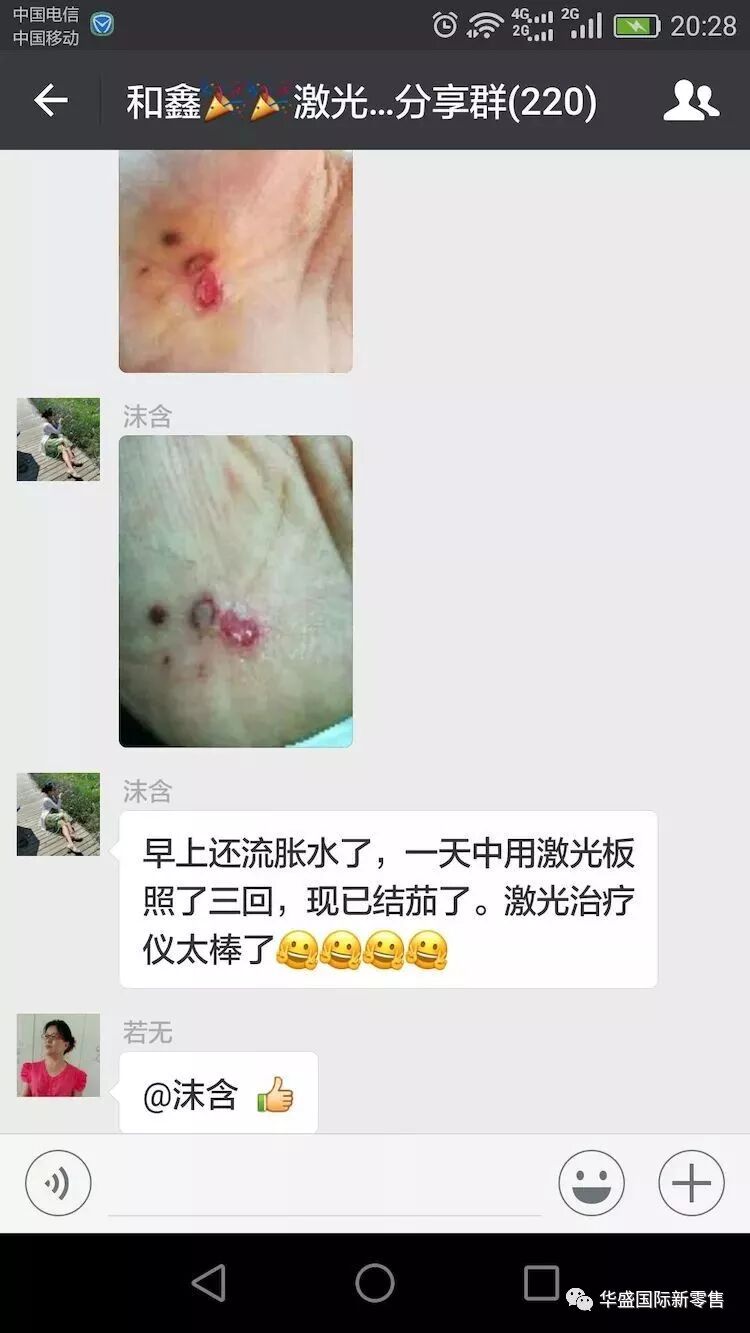 激光治疗仪能治什么病激光治疗仪案例整理【外伤，疼痛，皮肤疾病】_https://www.jmylbn.com_新闻资讯_第49张