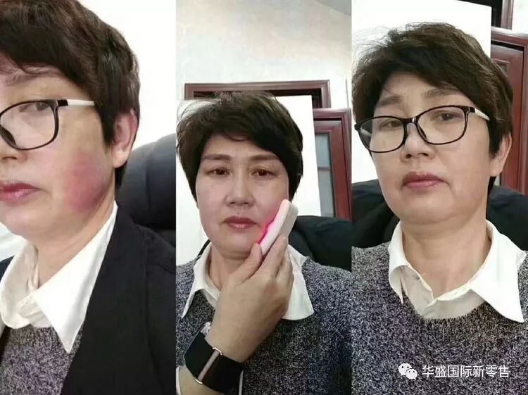 激光治疗仪能治什么病激光治疗仪案例整理【外伤，疼痛，皮肤疾病】_https://www.jmylbn.com_新闻资讯_第13张