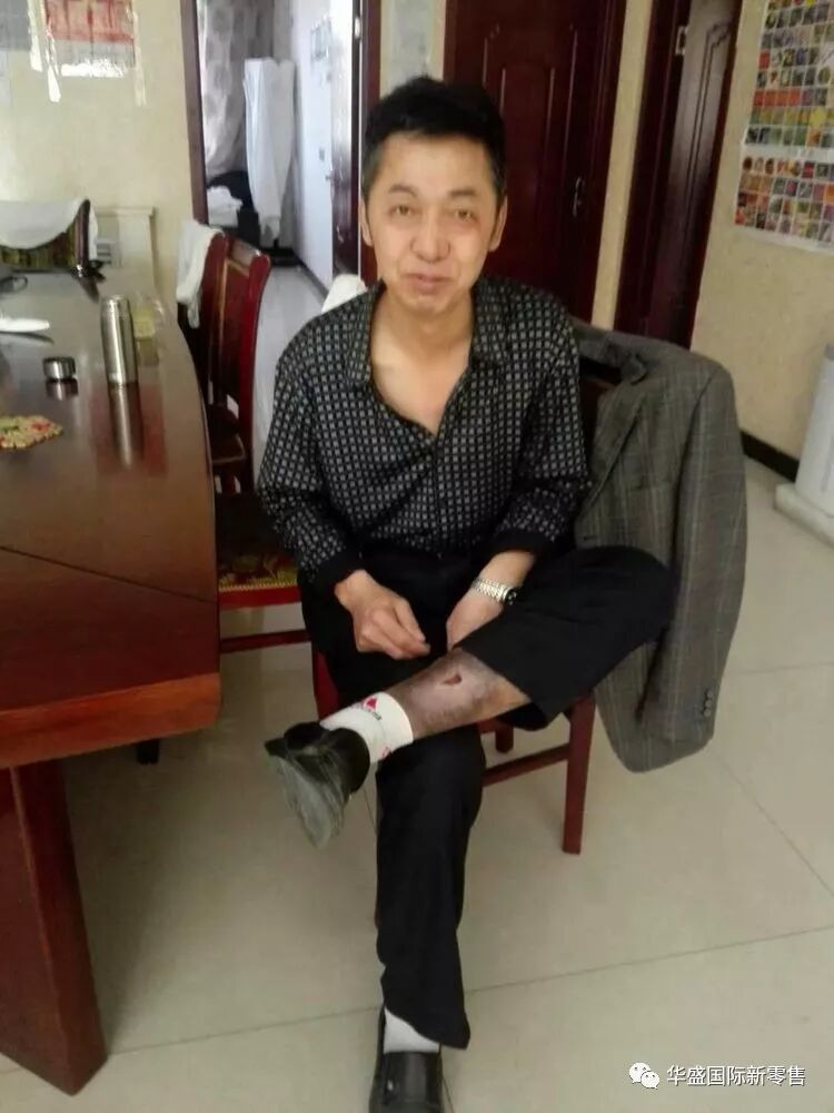 激光治疗仪能治什么病激光治疗仪案例整理【外伤，疼痛，皮肤疾病】_https://www.jmylbn.com_新闻资讯_第26张