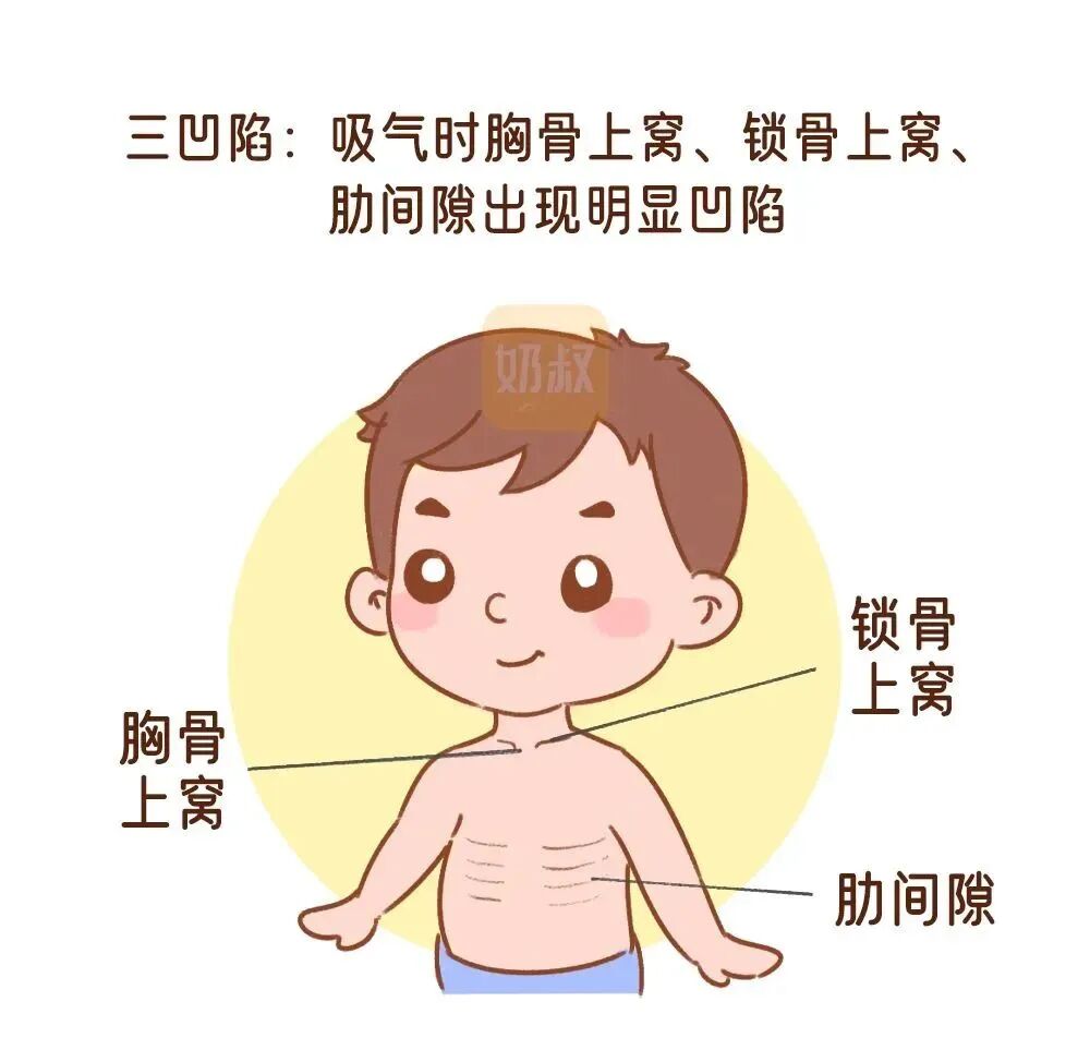 发烧1天后，肺部大片变白！已有孩子中招，快自查！ - 脉脉