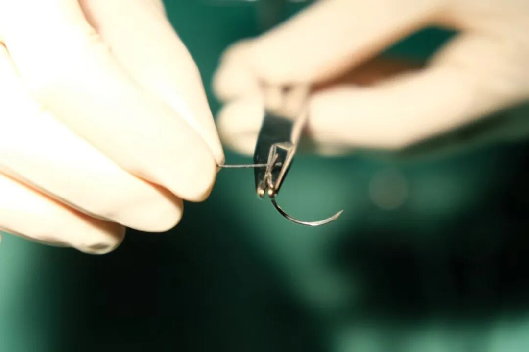 缝合时怎么持钳【你不知道的手术室】第4期：手术台旁的“神兵利器”——常用手术器械大盘点_https://www.jmylbn.com_新闻资讯_第6张