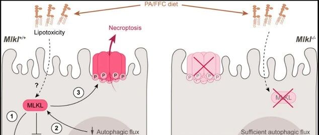 特别关注｜MLKL在ALD及NAFLD中的活化及潜在作用和机制研究