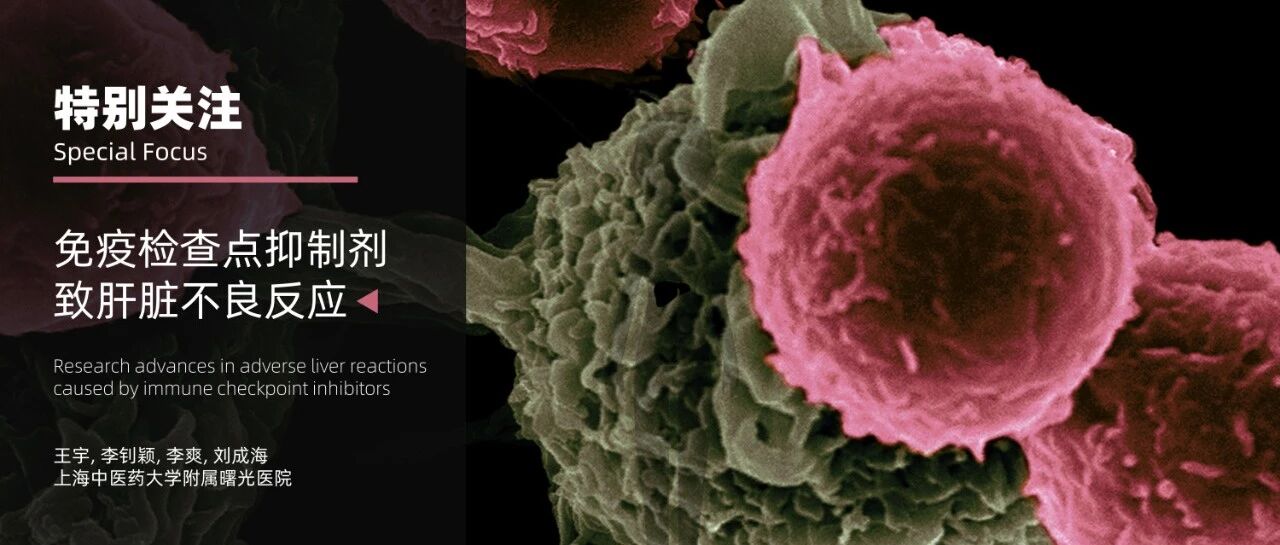 特别关注｜免疫抗肿瘤时代不可回避的问题——免疫检查点抑制剂肝损伤