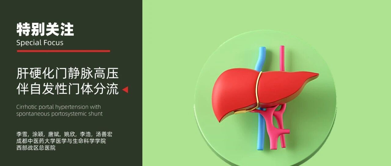 特别关注｜肝硬化门静脉高压伴自发性门体分流的产生、分类分型和临床意义