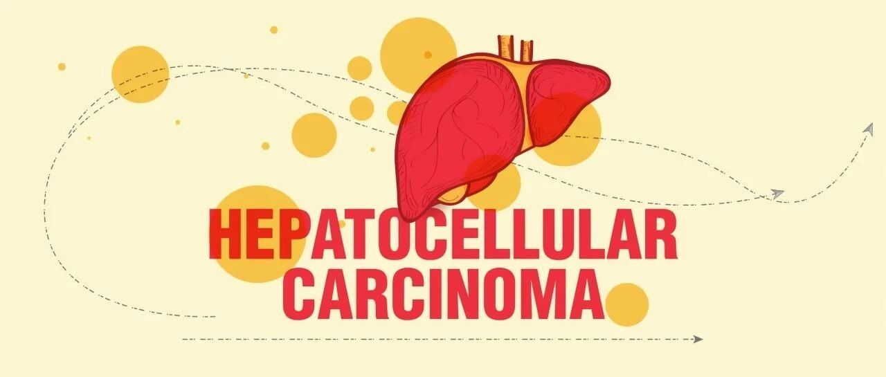 肝胆资讯｜接连失利，肝癌靶向单药治疗路在何方？