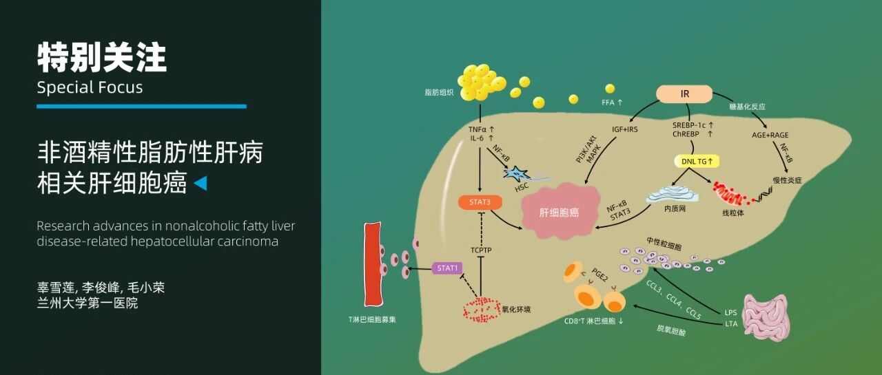 特别关注｜非酒精性脂肪性肝病相关肝细胞癌的发病机制与治疗