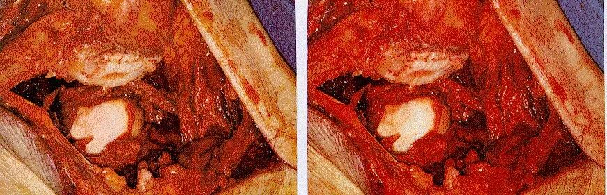 手术灯有什么作用控制手术灯亮度和色温 让我们一起呵护医生们最宝贵的眼睛_https://www.jmylbn.com_新闻资讯_第4张