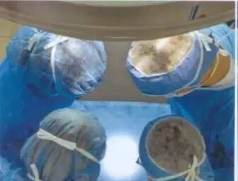 手术灯有什么作用控制手术灯亮度和色温 让我们一起呵护医生们最宝贵的眼睛_https://www.jmylbn.com_新闻资讯_第3张