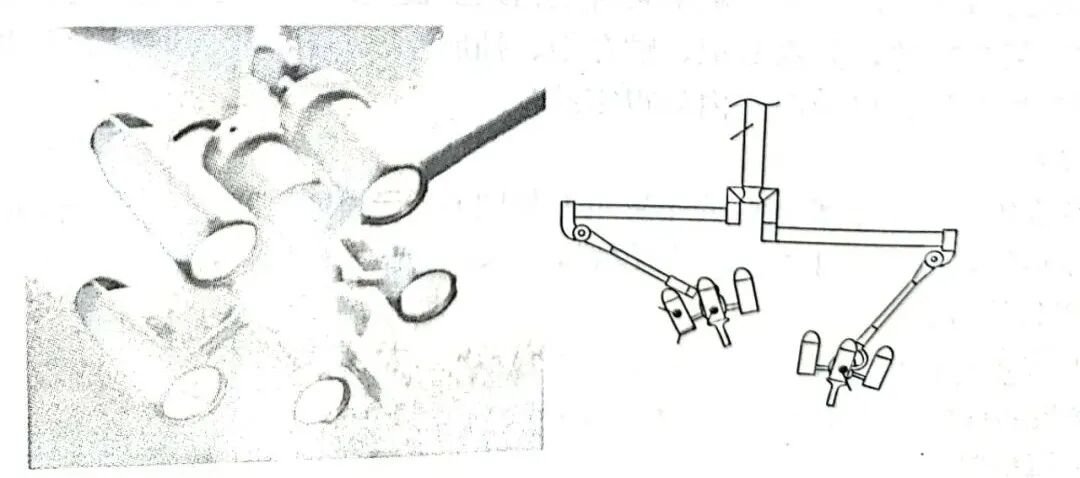 无影灯怎么安装洁净手术室基本装备-无影灯安装技术要点_https://www.jmylbn.com_新闻资讯_第5张