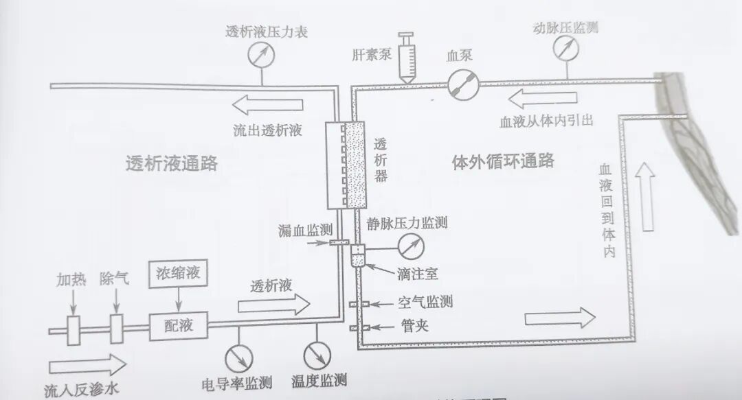 血透机需要哪些耗材血液透析机使用中需着重注意这几点环境风险因素_https://www.jmylbn.com_新闻资讯_第2张