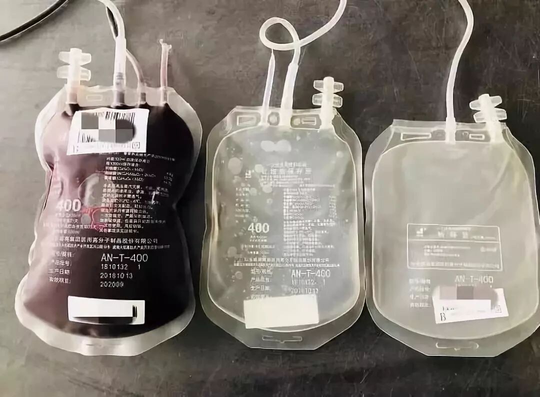 血袋号是什么【献血科普】献血时的血袋为什么不止一个？_https://www.jmylbn.com_新闻资讯_第2张