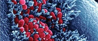 《Science》细菌/烟酰胺能对抗神经退化吗？