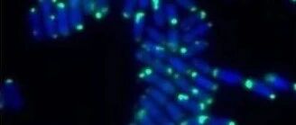 《Nature Aging》一款去除衰老细胞的“延寿”疫苗？