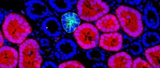 为了自杀？癌细胞吞噬自己的原因到底是什么