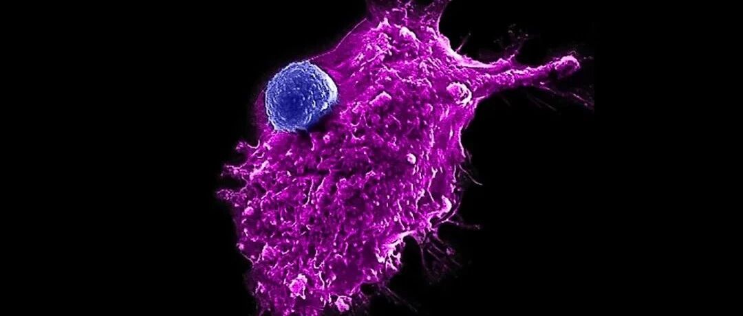 加州大学华人学者针对癌症的“现成”低成本免疫细胞疗法