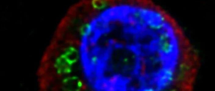 另类自噬解释大脑的独特“垃圾清理”模式