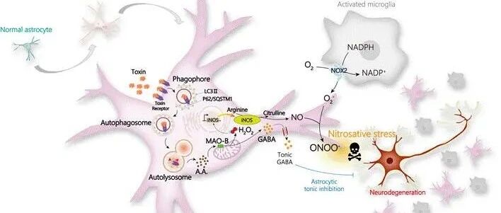 不可预测的阿尔兹海默症，现在找到病“根”了