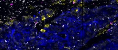 《Nature》你吃的所有药物都被你的肠道细菌吃掉了！？