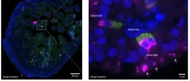 首次发现人类胎儿肠道内分泌细胞可以表达胰岛素，糖尿病治疗或将迎来突破！