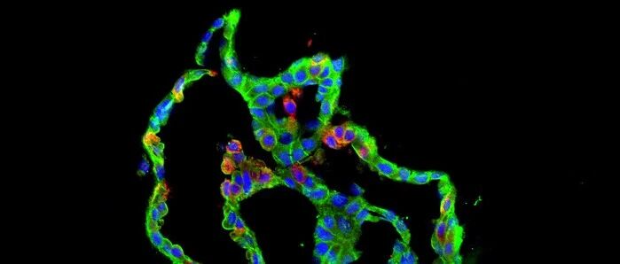 一篇文章解释为什么Kras在肿瘤形成中如此特殊？