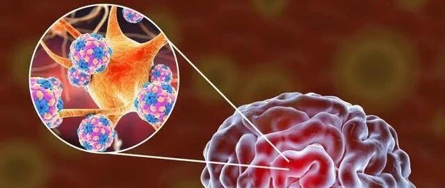 首个证据！SARS-CoV-2有可能感染人脑器官