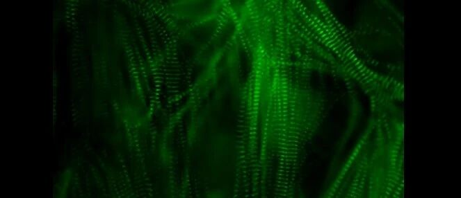 Nature重磅成果：人类心脏细胞的第一个图谱