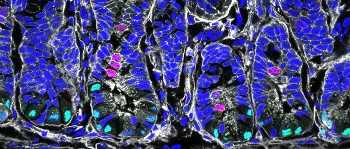 《Nature Metabolism》封面故事：饮食、肠道干细胞和疾病之间的新联系