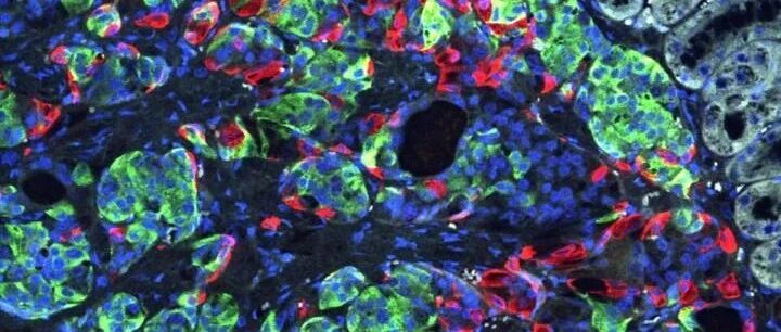 值得期待！Cell子刊发现一种天然存在的代谢产物可延长寿命