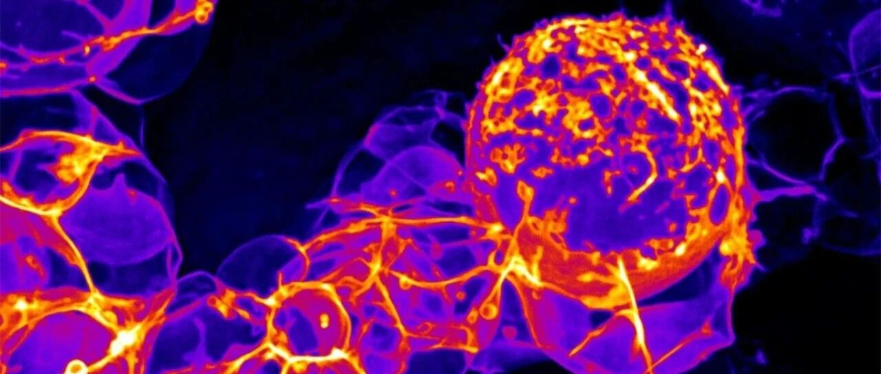 Nature新见解：因为它们，CAR T才能有效治疗白血病
