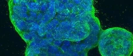 靶向治疗癌症的新方法：“合成致死”