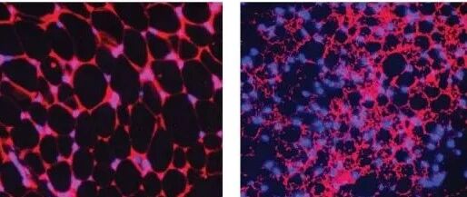 肥胖的人往往没有那么多有益的脂肪，那么可以人为添加吗？