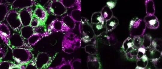 结论离经叛道！不管你晒太阳还是吃药，肠道微生物决定你能储存多少VD