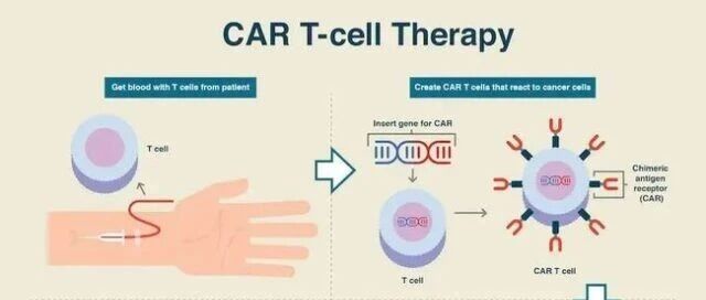 中国首个CAR-T疗法：患者的癌细胞在两个月内被清除