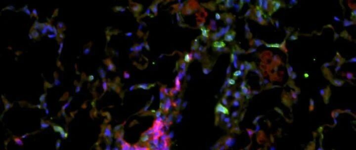 《Cell》靶向RNA剪接，激发内源抗肿瘤力量