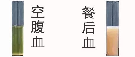 噓，​抽血體檢，我沒空腹，結果…… 健康 第6張