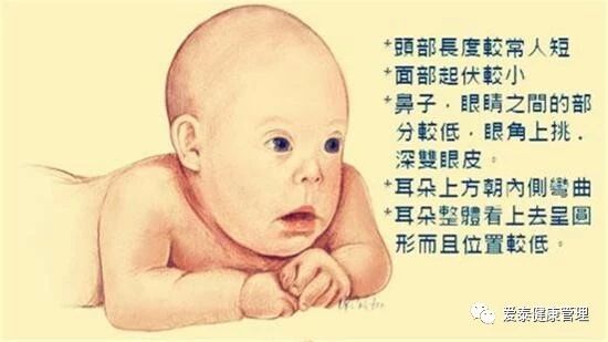 三代试管如何预防唐氏综合征 - 泰国试管婴儿知识 - 河南爱泰试管咨询