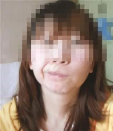 领赴韩国整形做整形手术整成 永远的歪嘴 杜杜家医美课堂 微信公众号文章阅读 Wemp
