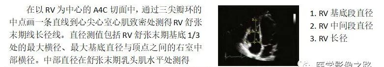 什么叫超声容积探头医学超声影像学笔记——心脏正常的解剖和超声评价_https://www.jmylbn.com_新闻资讯_第12张