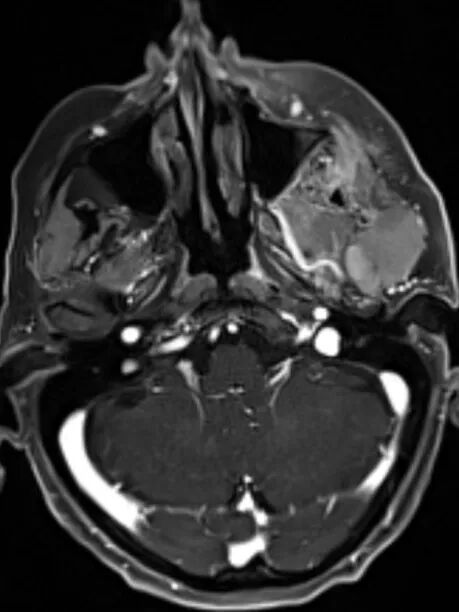 磁共振矩阵怎么计算【重磅】新一代智慧型生命感知磁共振——MAGNETOM Vida， 成功落户中大放射并全面投入使用！！！_https://www.jmylbn.com_新闻资讯_第48张