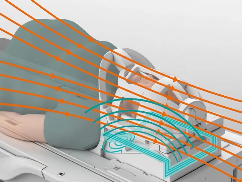 磁共振矩阵怎么计算【重磅】新一代智慧型生命感知磁共振——MAGNETOM Vida， 成功落户中大放射并全面投入使用！！！_https://www.jmylbn.com_新闻资讯_第9张