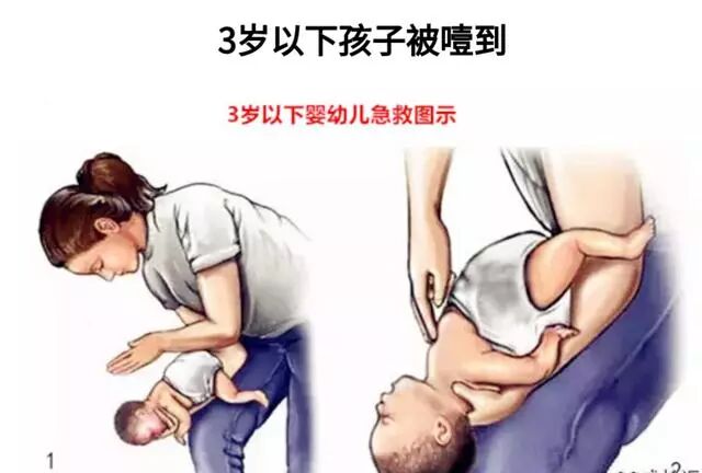 如此行之有效的急救法愿每个家长都能学会但永远用不到