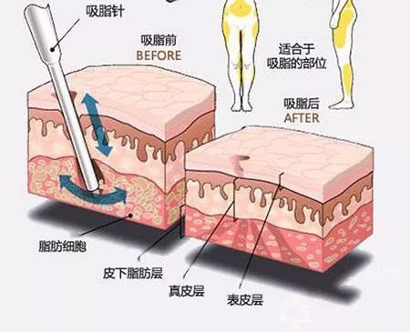 每逢佳節胖三斤，年底不瘦身年後徒傷悲～ 運動 第12張